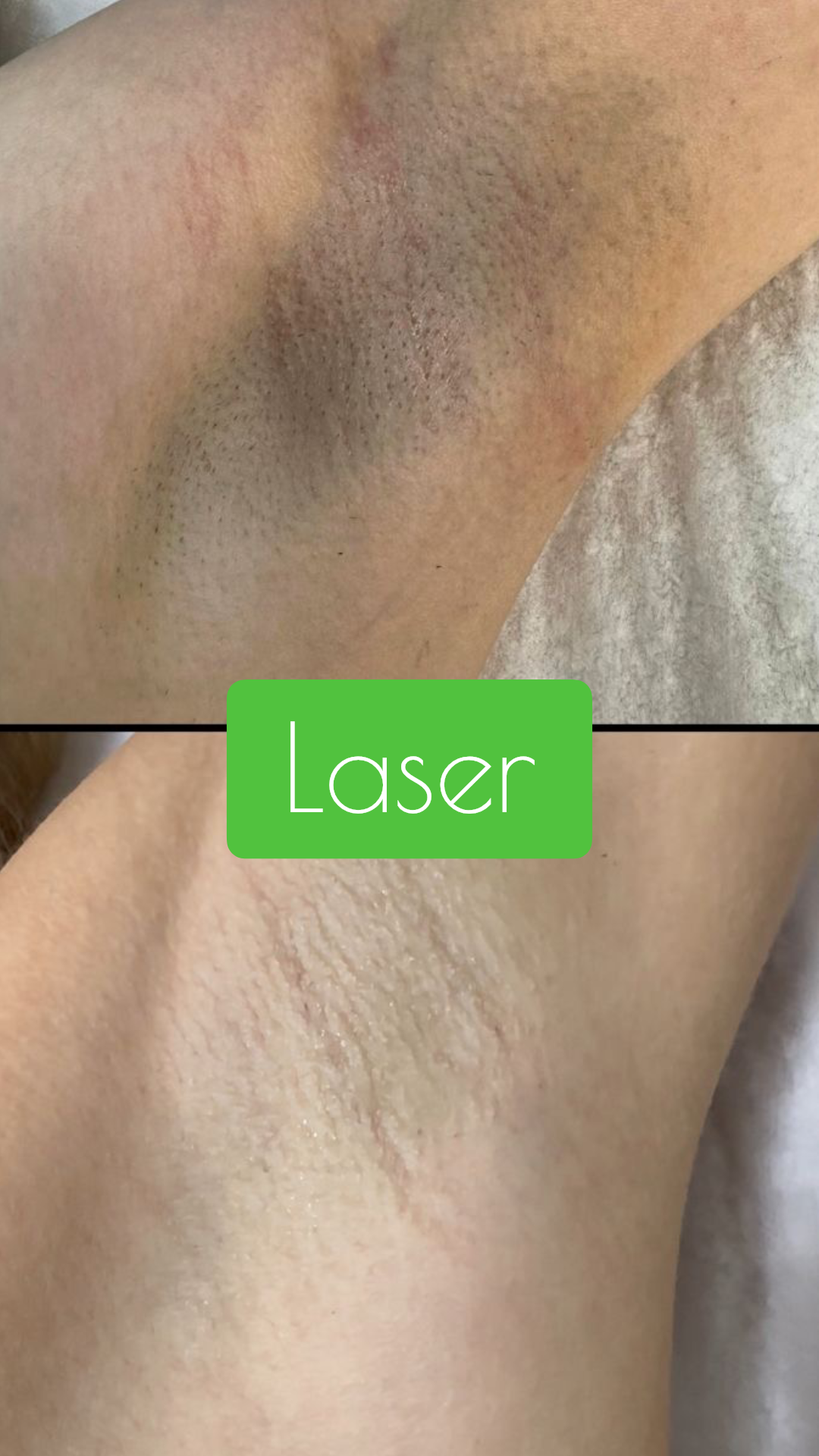 instories_49522654-D291-44C4-9281-8EFAD8F59183