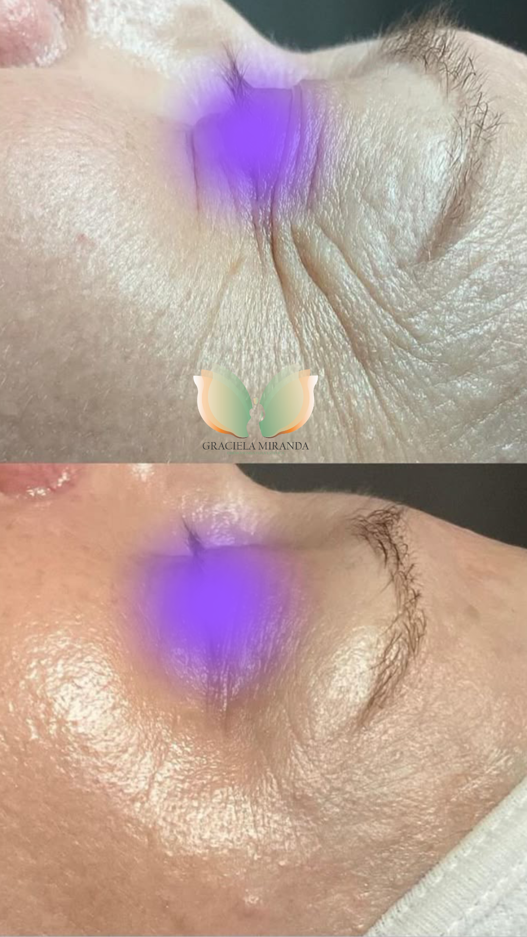 instories_807B270A-3ECA-48EE-8E88-1DA68F702104